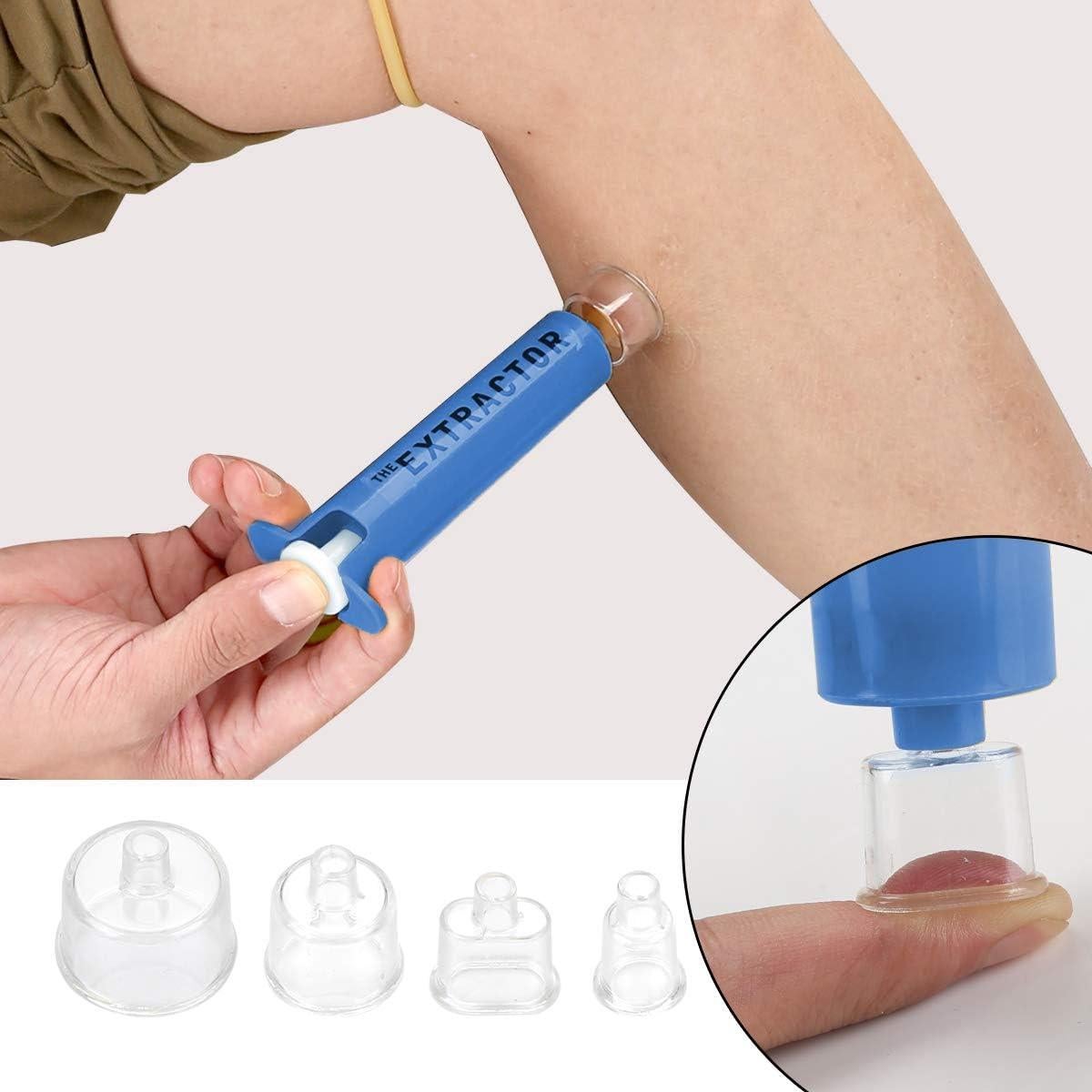 Kit de primeros auxilios DLY para mordeduras y picaduras