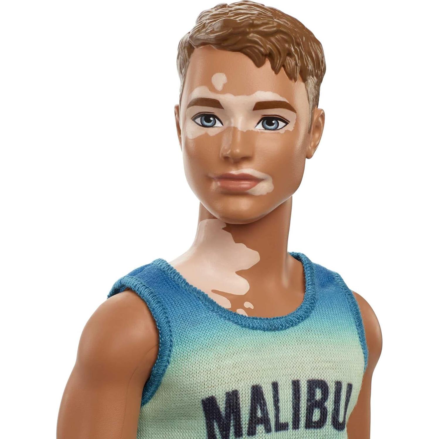 Muñeco Ken Fashionistas Mattel #192 con Vitiligo y Atuendo Playa