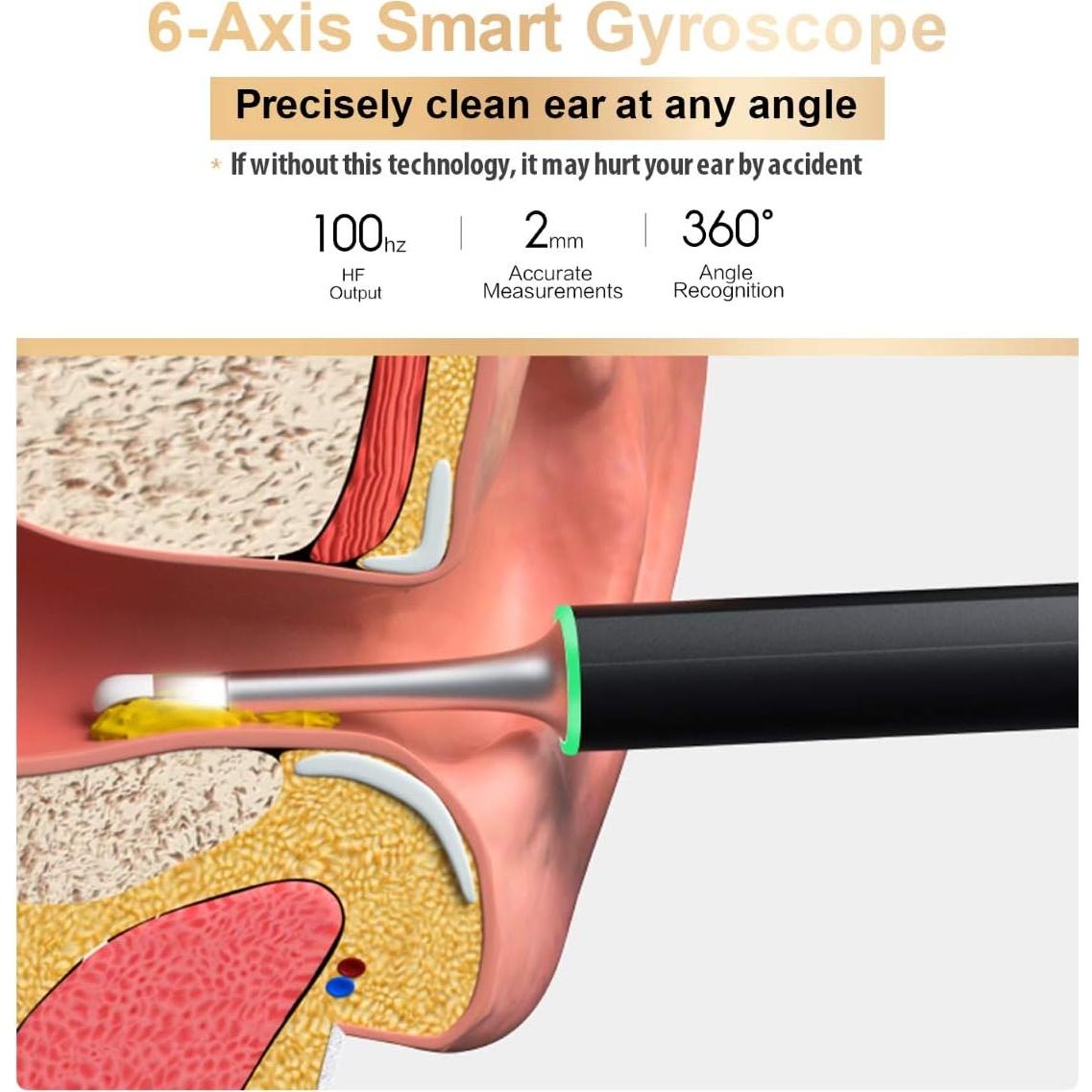 Cámara de limpieza de oídos BEBIRD X17 Pro, WiFi, 1080p