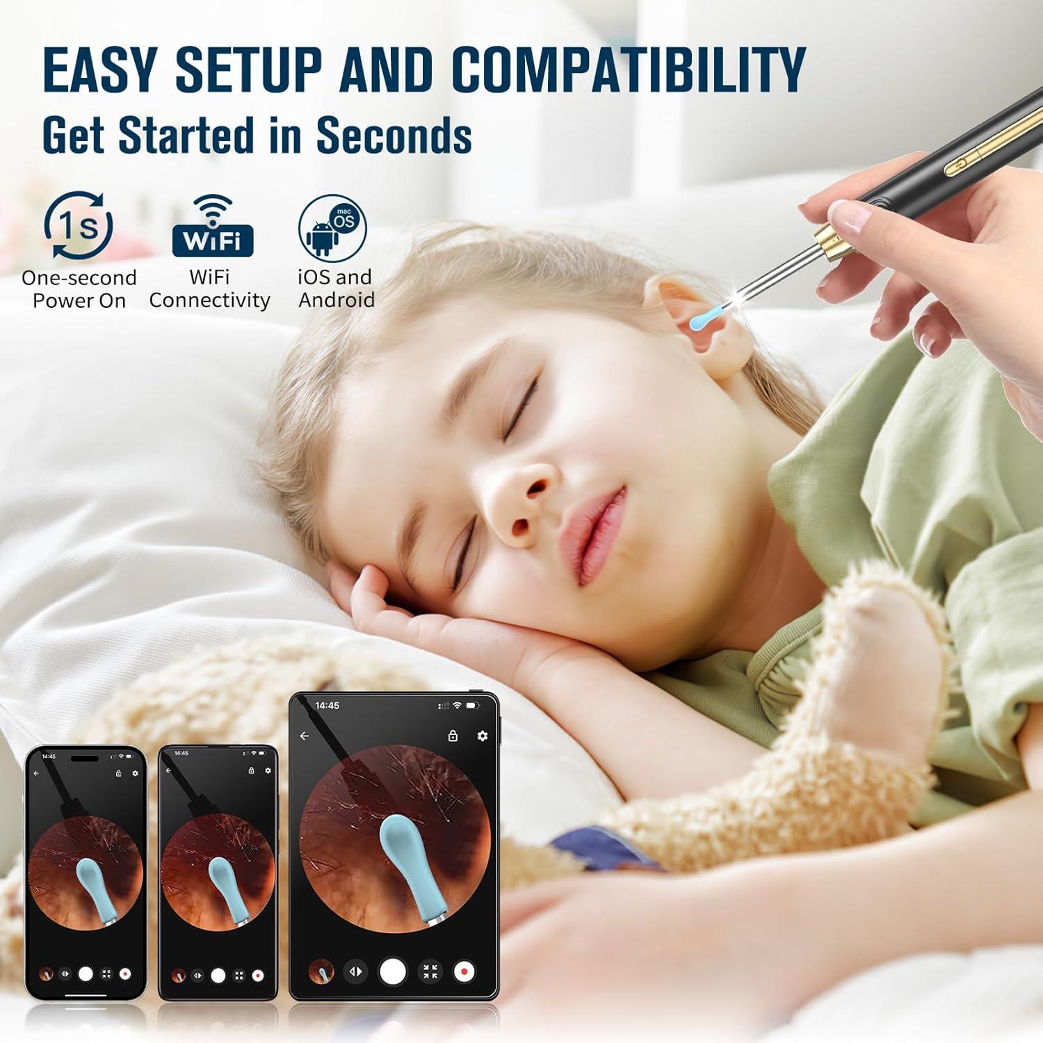 Limpiador de Oídos Kekoy P8 con Cámara HD 1296P y Accesorios