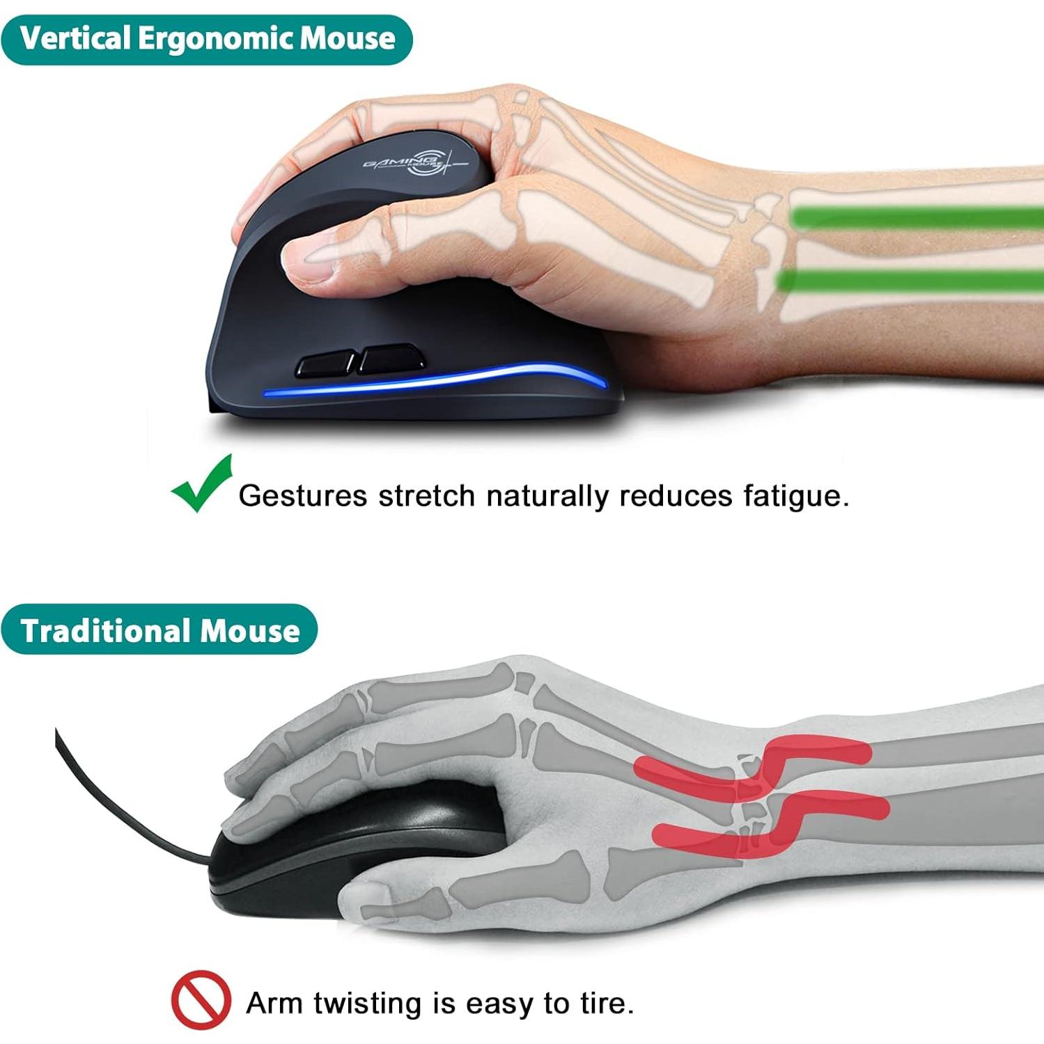 Mouse Inalámbrico TRELC F-35 Vertical Ergonómico 3 DPI 800mA