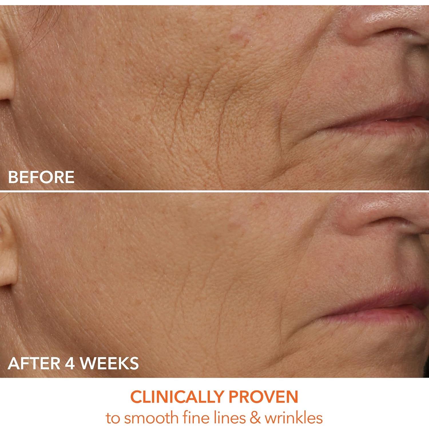 Máscara LED Dr. Dennis Gross FaceWare Pro - Anti-envejecimiento