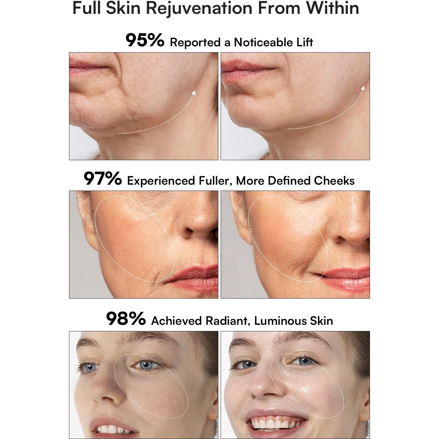 Masajeador Facial INIA 3 en 1 Microcorriente y Luz Roja