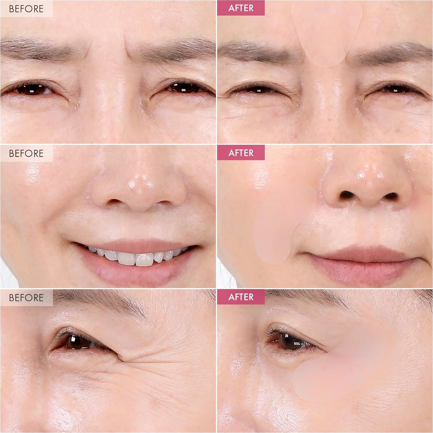 Parches Antienvejecimiento MANTONG 10 Parches Hidratantes