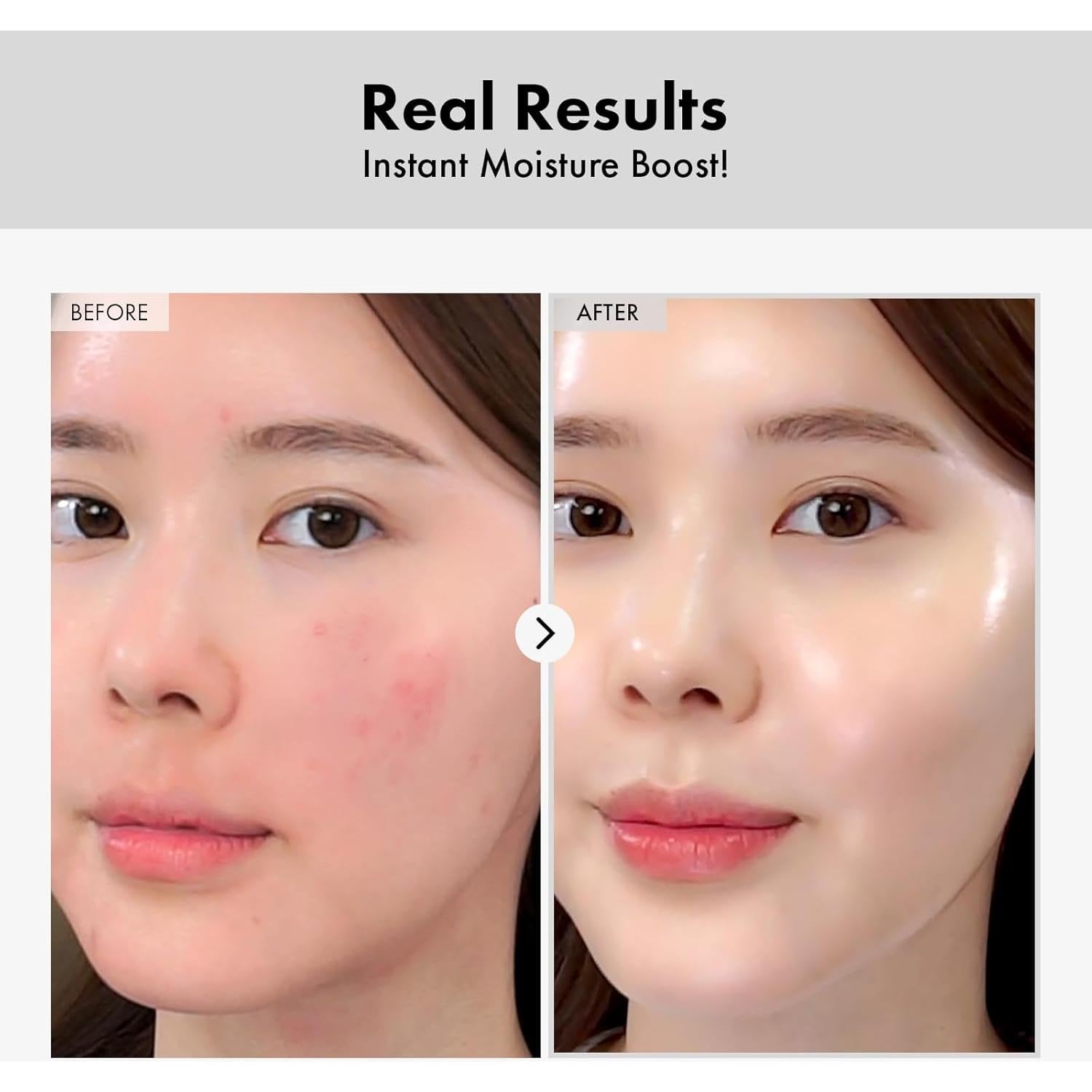 Ampolla de Ácido Hialurónico MANTONG 100ml Hidratante Facial