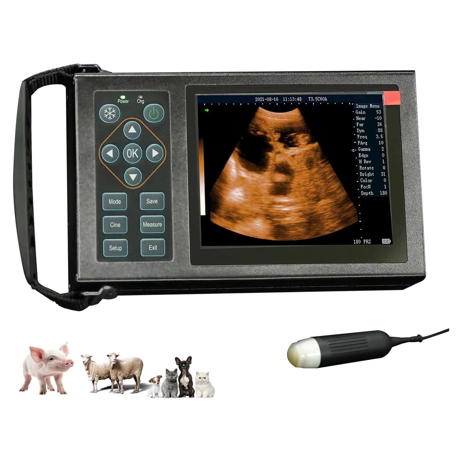 Máquina de Ultrasonido Portátil Ruisheng M10 5.6" para Embarazo