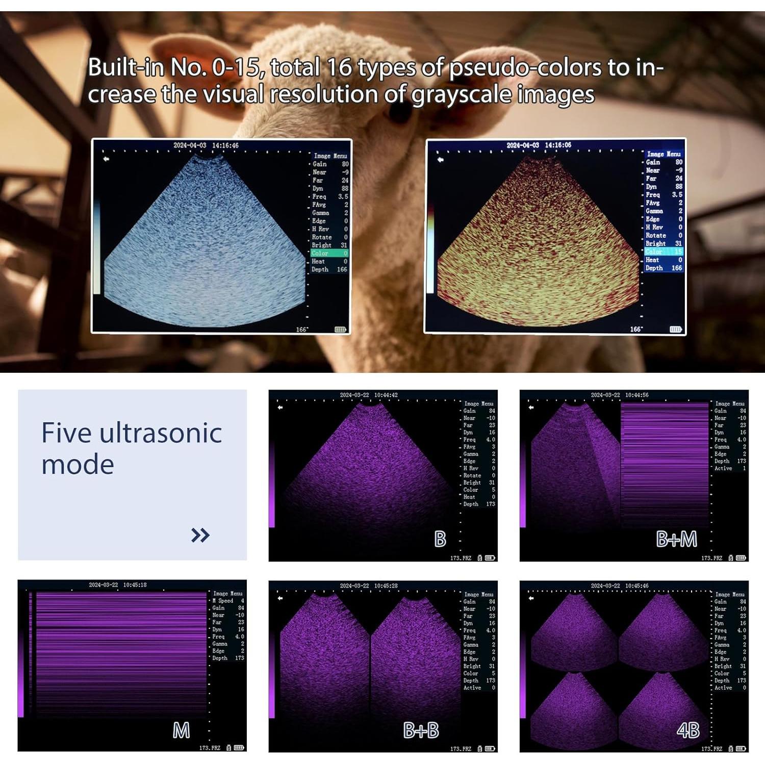 Máquina de Ultrasonido Portátil Ruisheng M10 5.6" para Embarazo