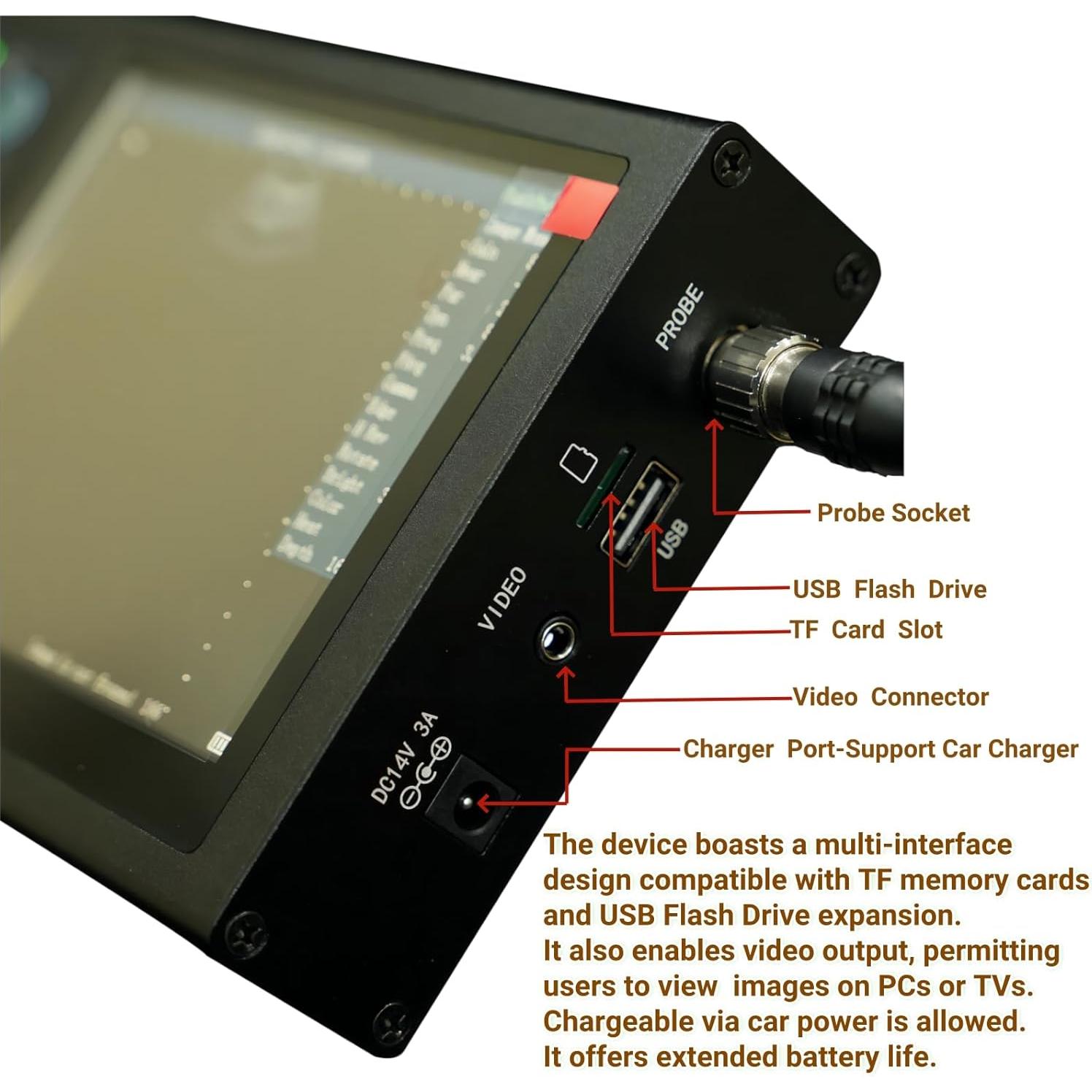 Máquina de Ultrasonido Portátil Ruisheng M10 5.6" para Embarazo