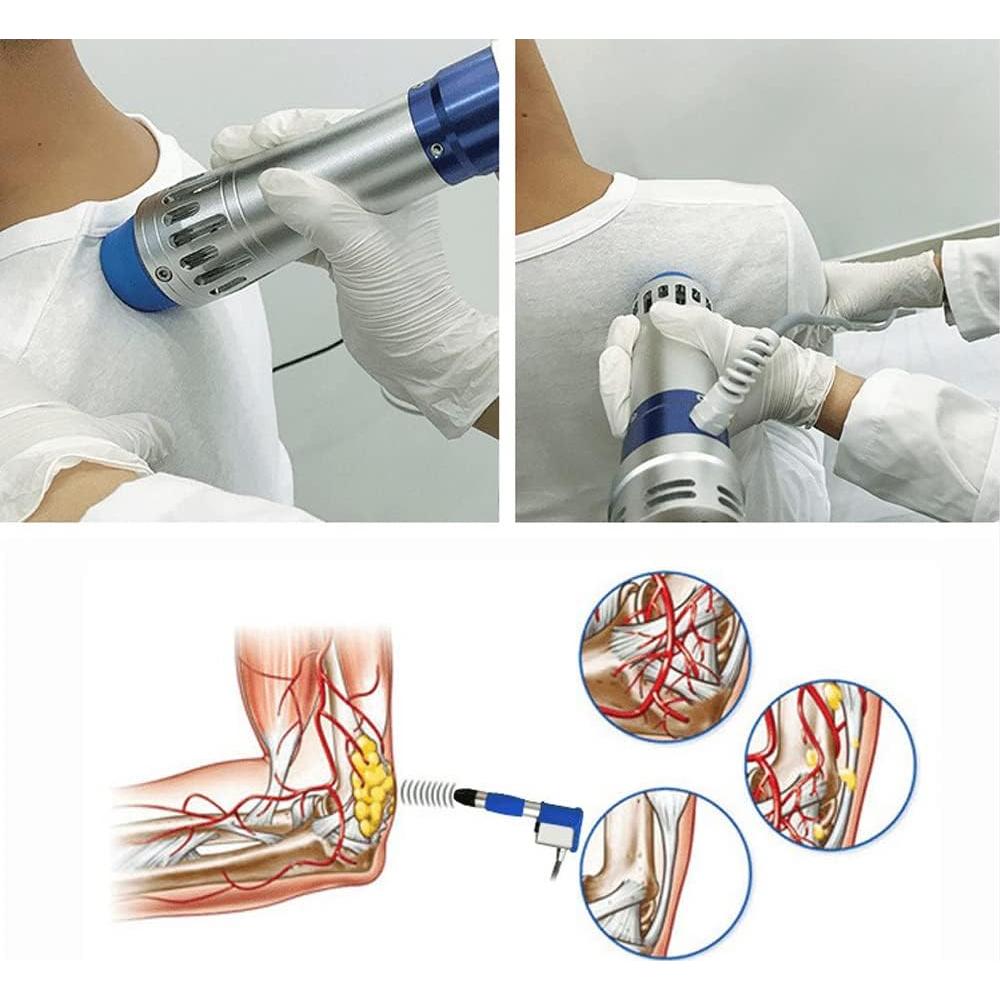 Máquina de Terapia de Ondas de Choque Shefmon SW14B 4.5kg