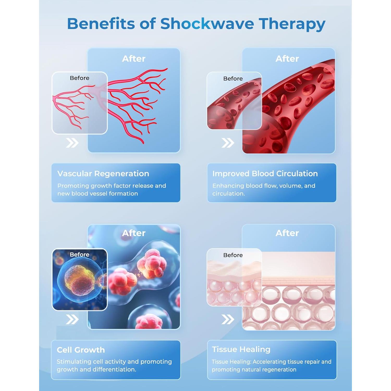 Máquina de Terapia de Ondas de Choque SHOCK VITALIZE S02-Mega para Alivio del Dolor