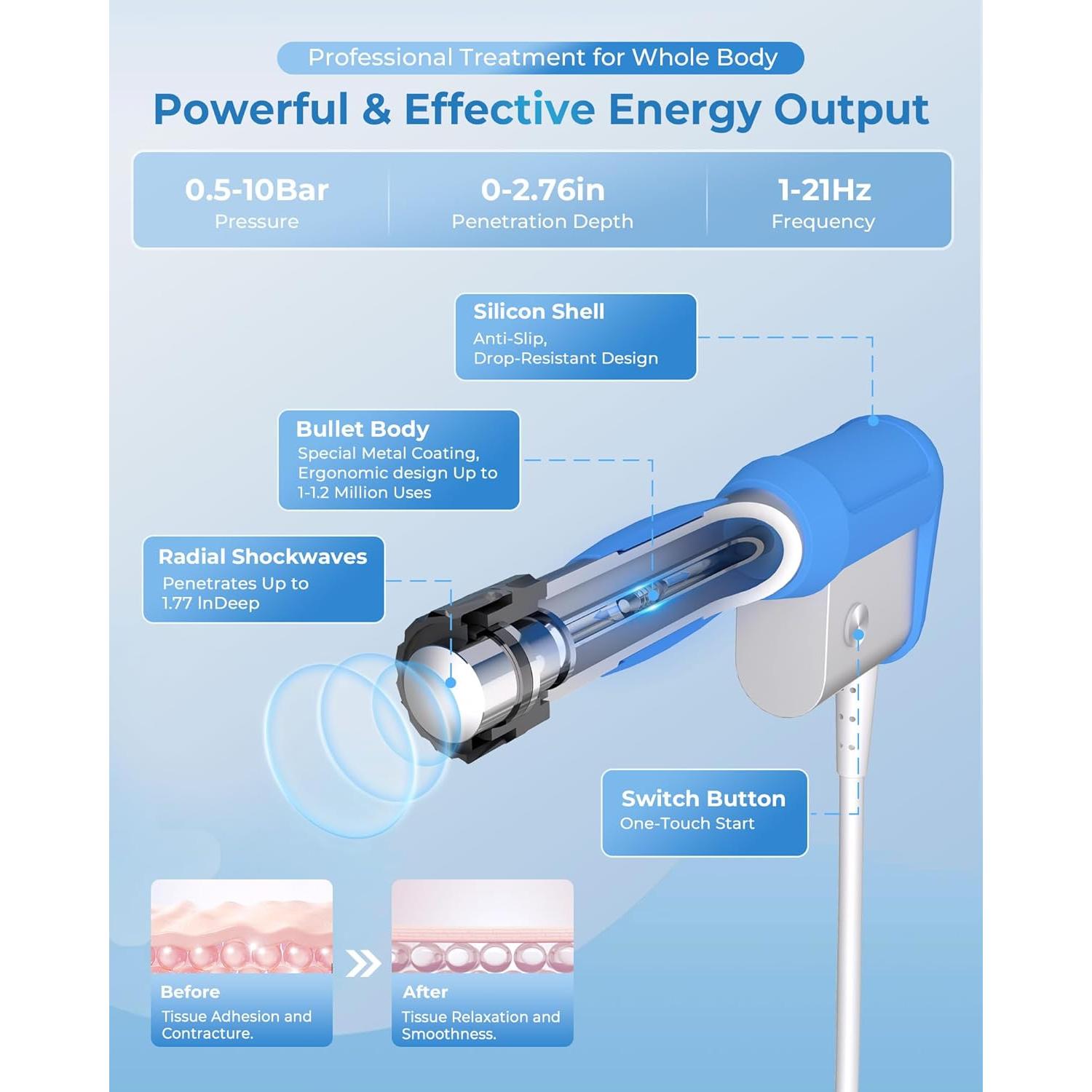Máquina de Terapia de Ondas de Choque SHOCK VITALIZE S02-Mega para Alivio del Dolor
