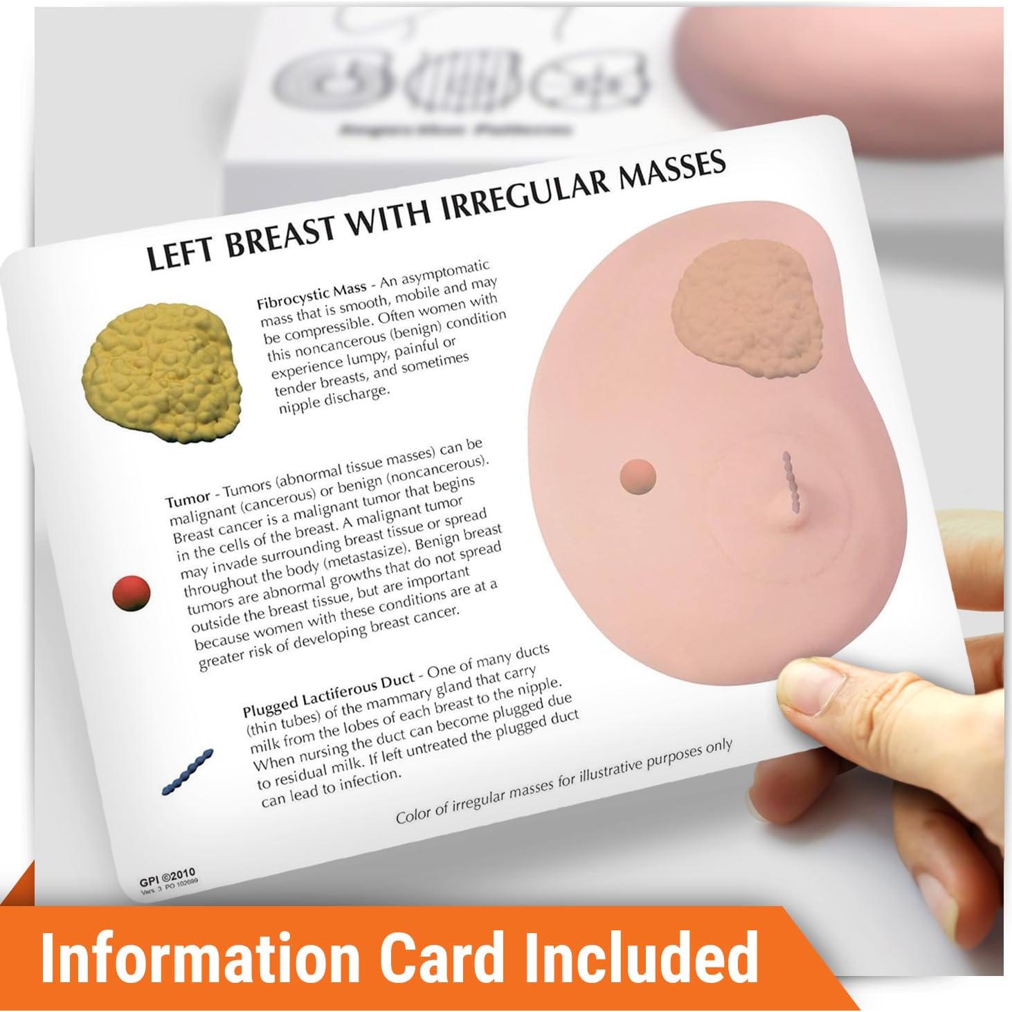 Modelo de Anatomía Humana de Mama Izquierda GPI Anatomicals