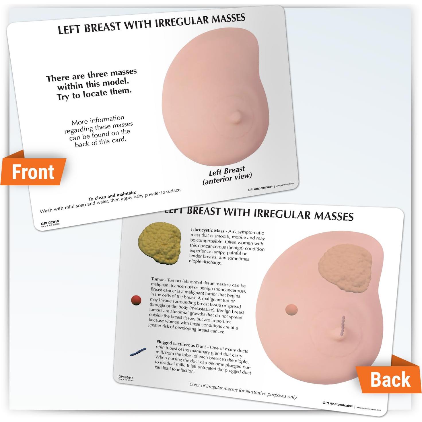 Modelo de Anatomía Humana de Mama Izquierda GPI Anatomicals