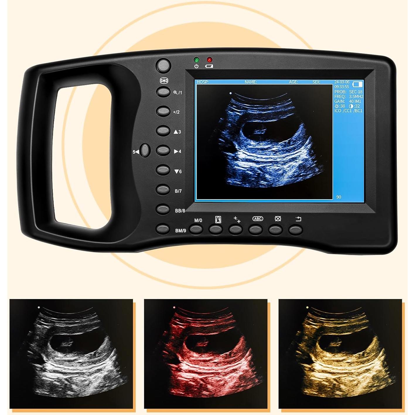 Escáner veterinario portátil DVK Sonda Convexa Micro 5.6" LED