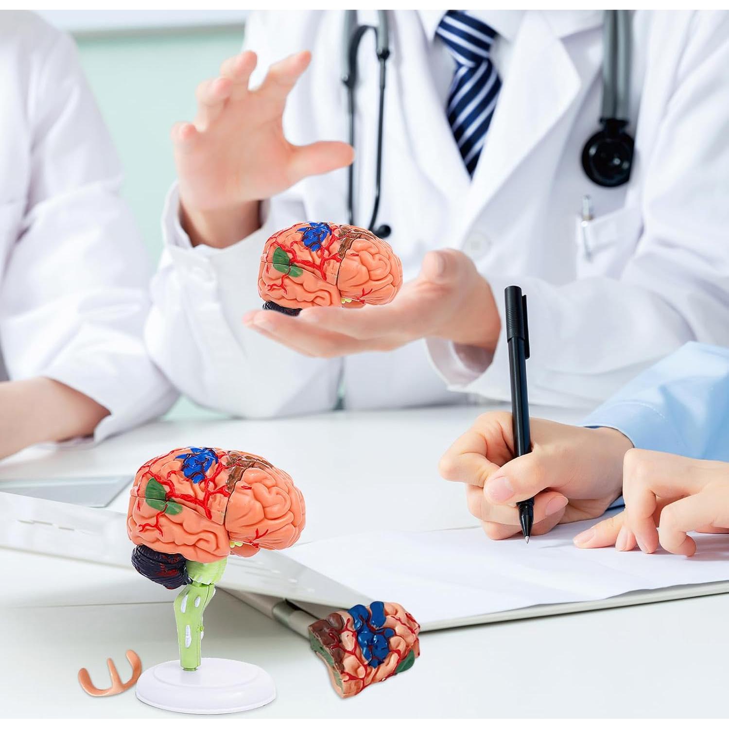 Modelo de Cerebro Humano 32 Piezas Ceonam - Herramienta Educativa