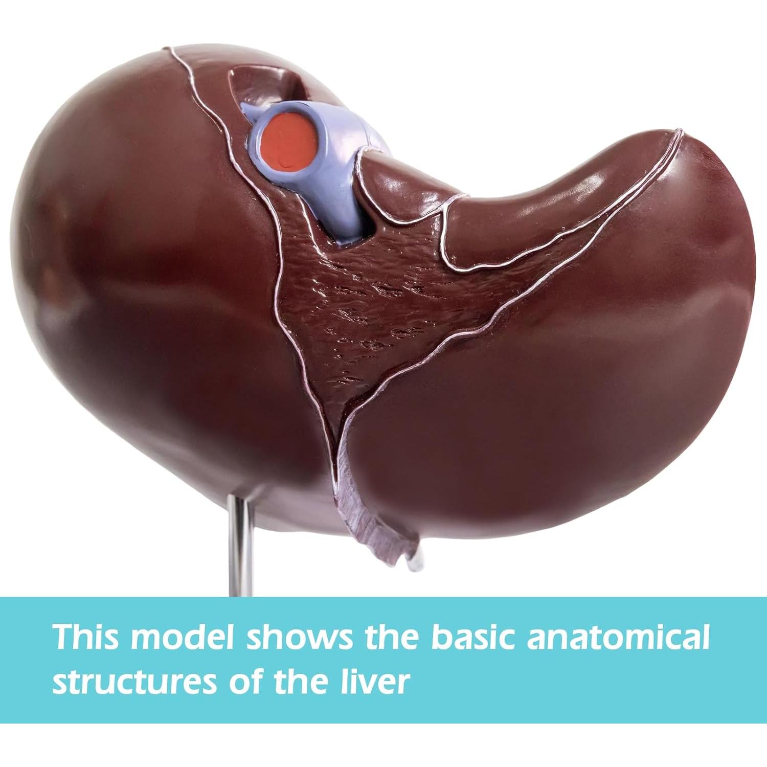 Modelo Anatómico Hígado Humano Deluxe Evotech 1.5X