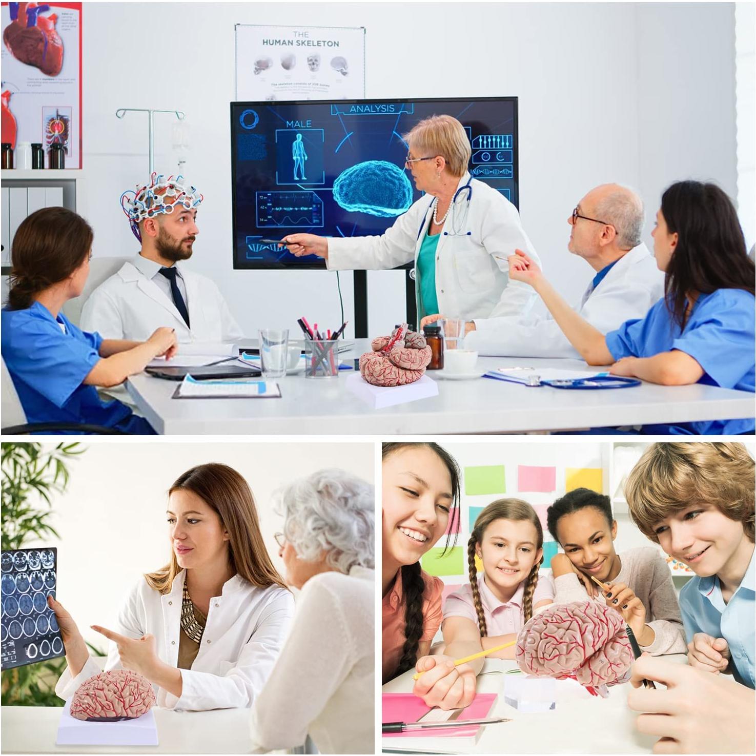 Modelo de Cerebro Humano LYOU 8 Partes PVC Educativo 13.97 cm