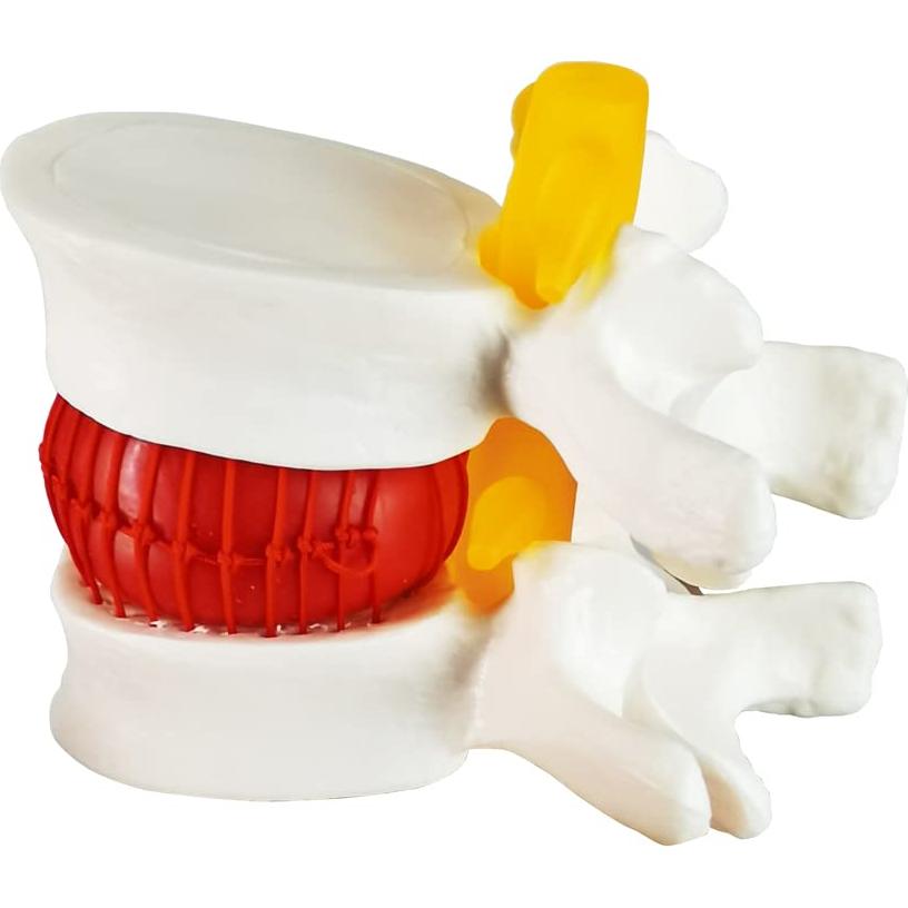 Modelo Anatómico de Columna Lumbar Humano NUEVO 2025 - PVC