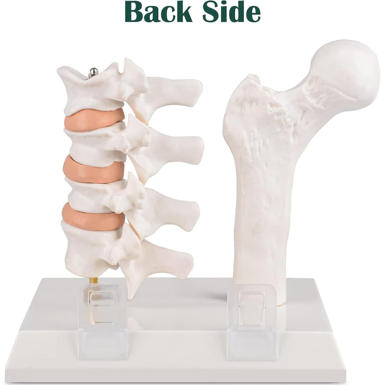 Modelo de Anatomía Humana Osteoporosis Ultrassist 20x20cm