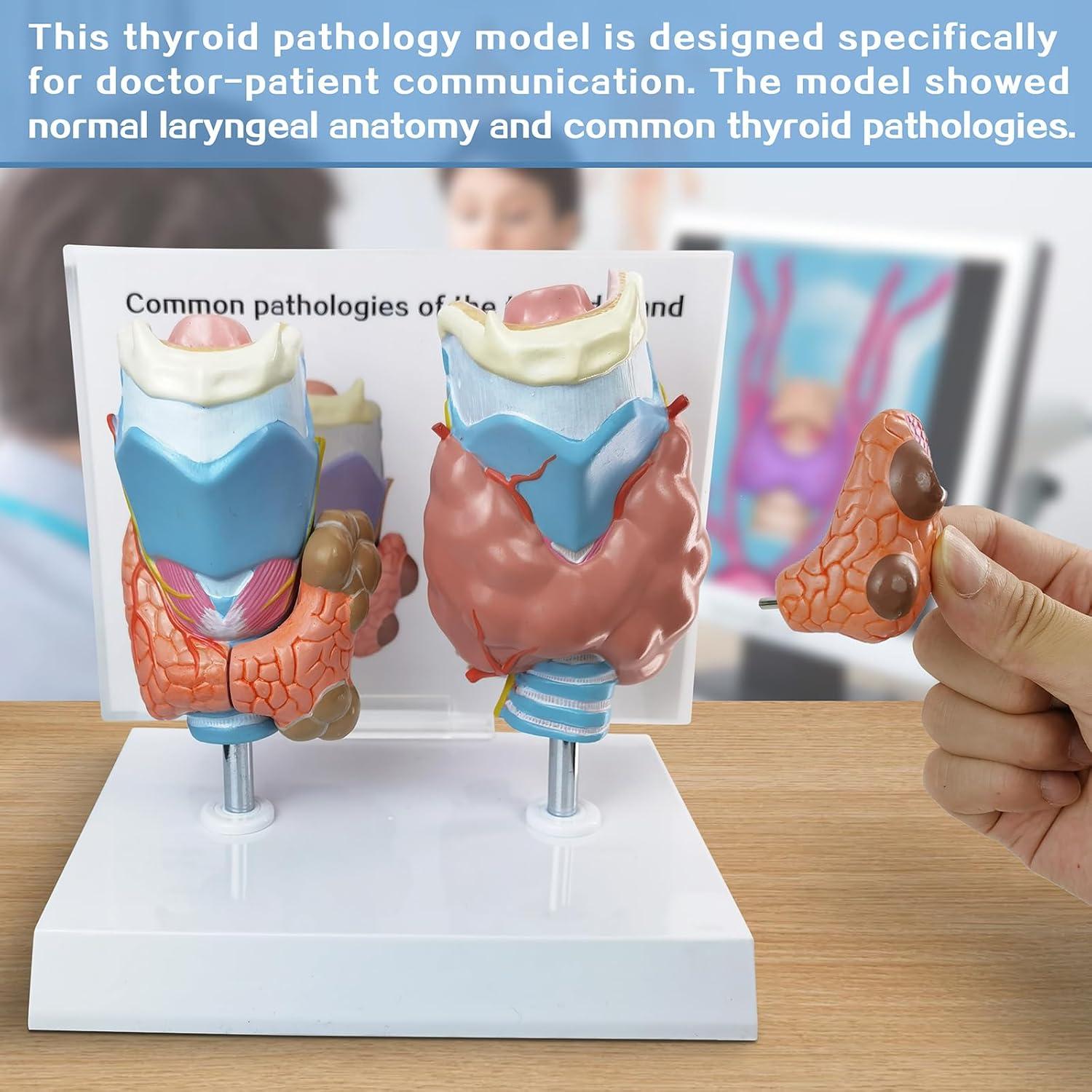 Modelo Anatómico de Tiroides Humana Evotech - 4 Partes