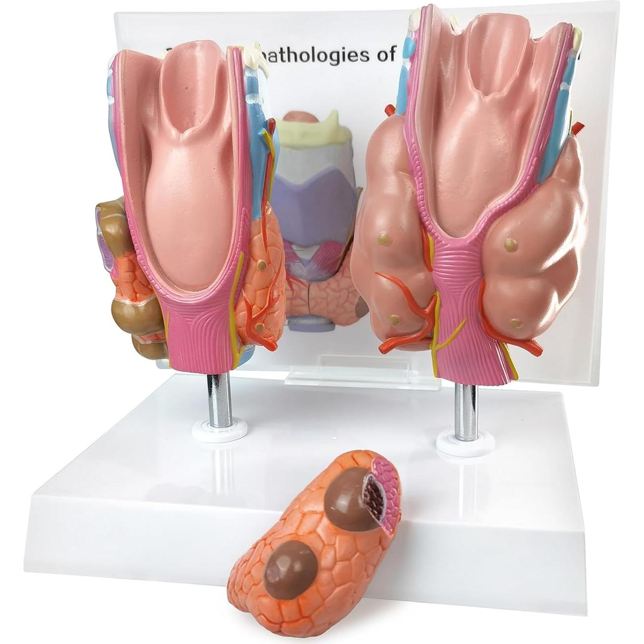 Modelo Anatómico de Tiroides Humana Evotech - 4 Partes
