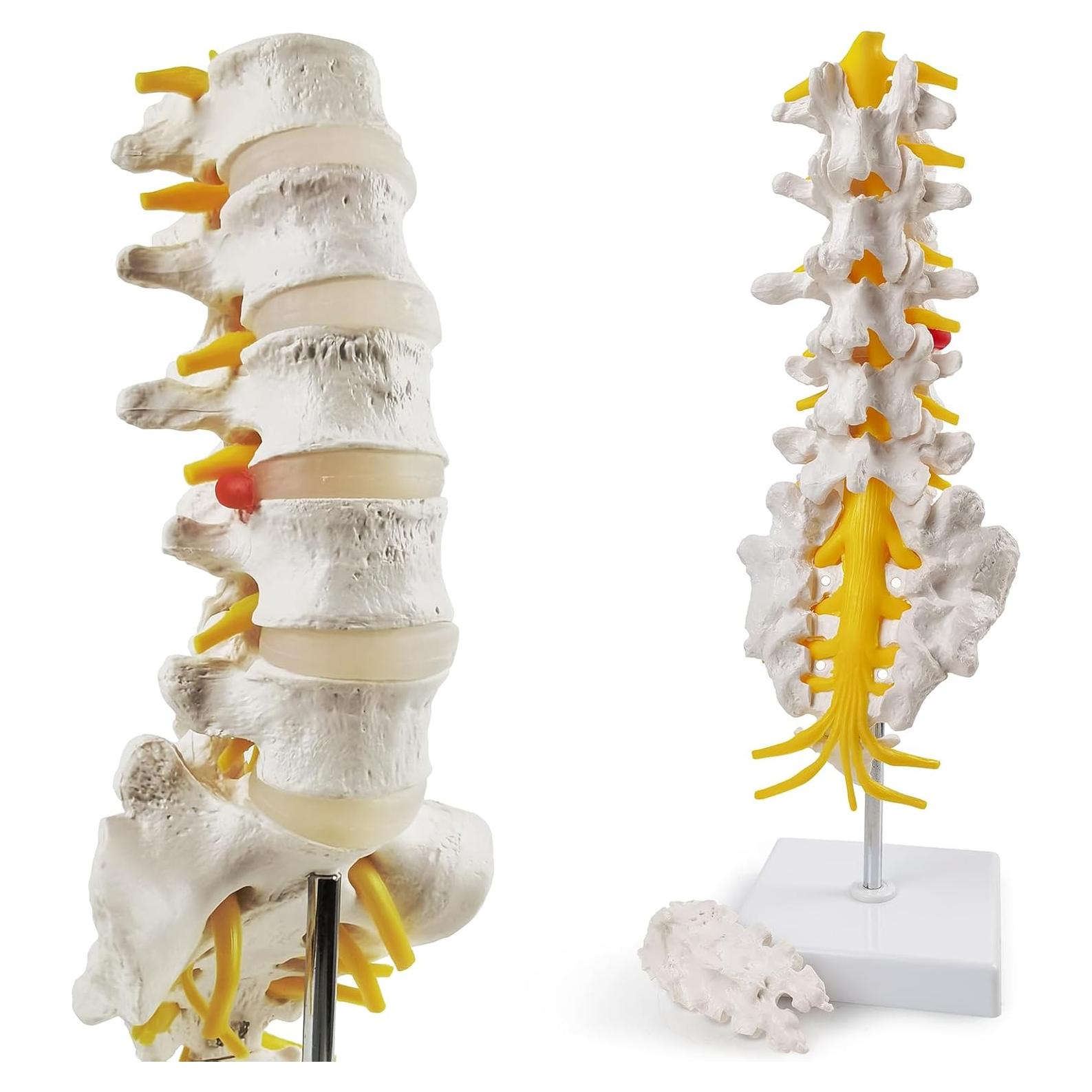 Modelo de Columna Lumbar 3D HADWYN - Anatomía Realista