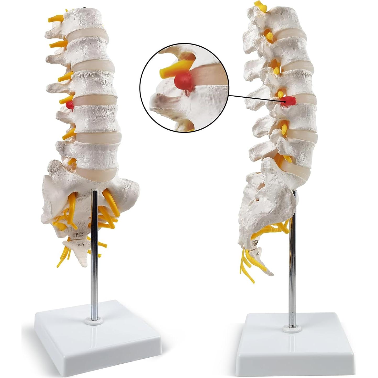 Modelo de Columna Lumbar 3D HADWYN - Anatomía Realista