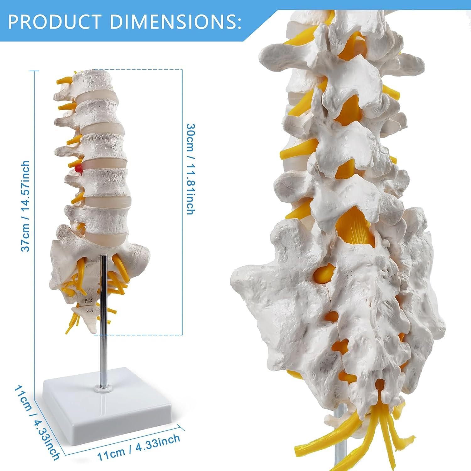 Modelo de Columna Lumbar 3D HADWYN - Anatomía Realista