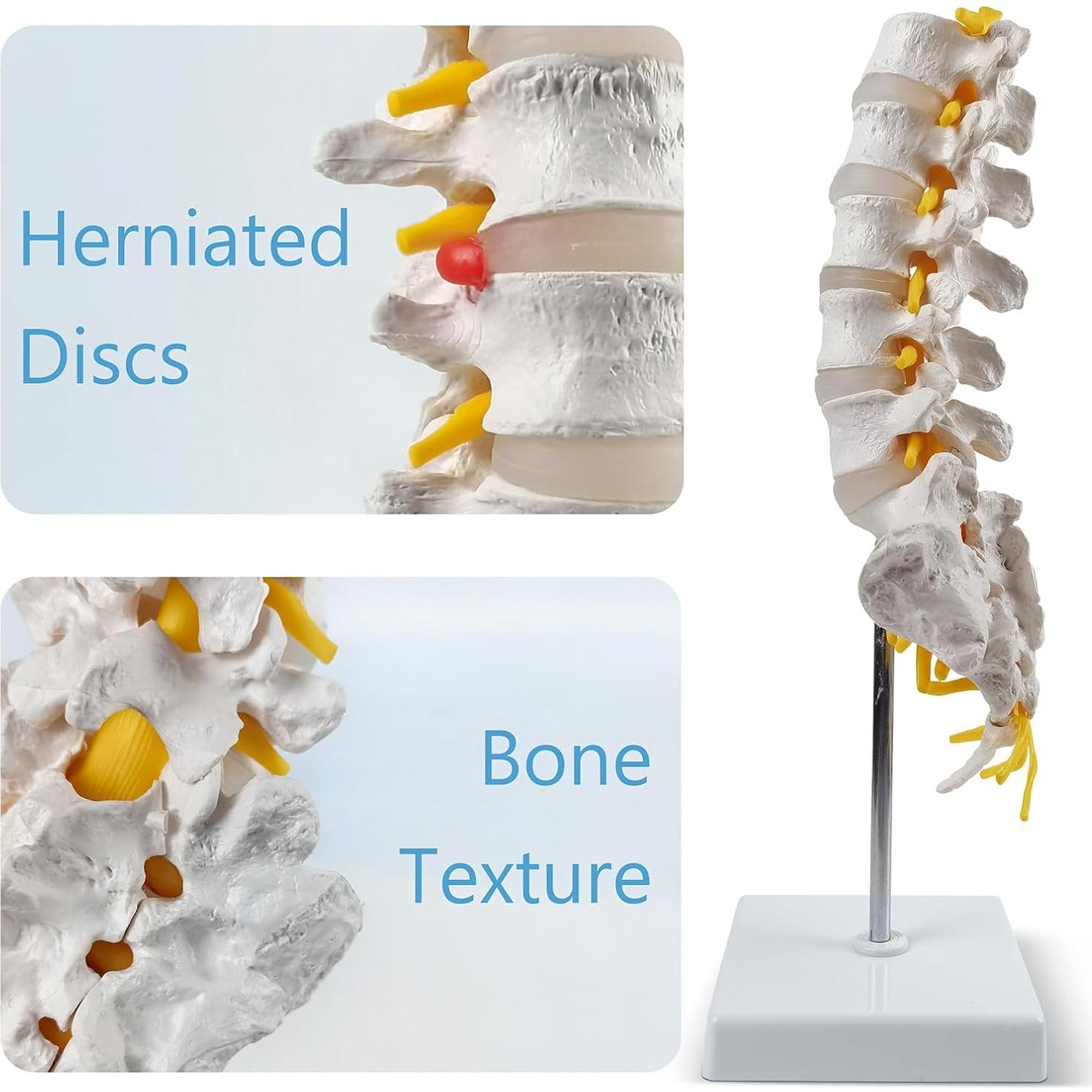 Modelo de Columna Lumbar 3D HADWYN - Anatomía Realista