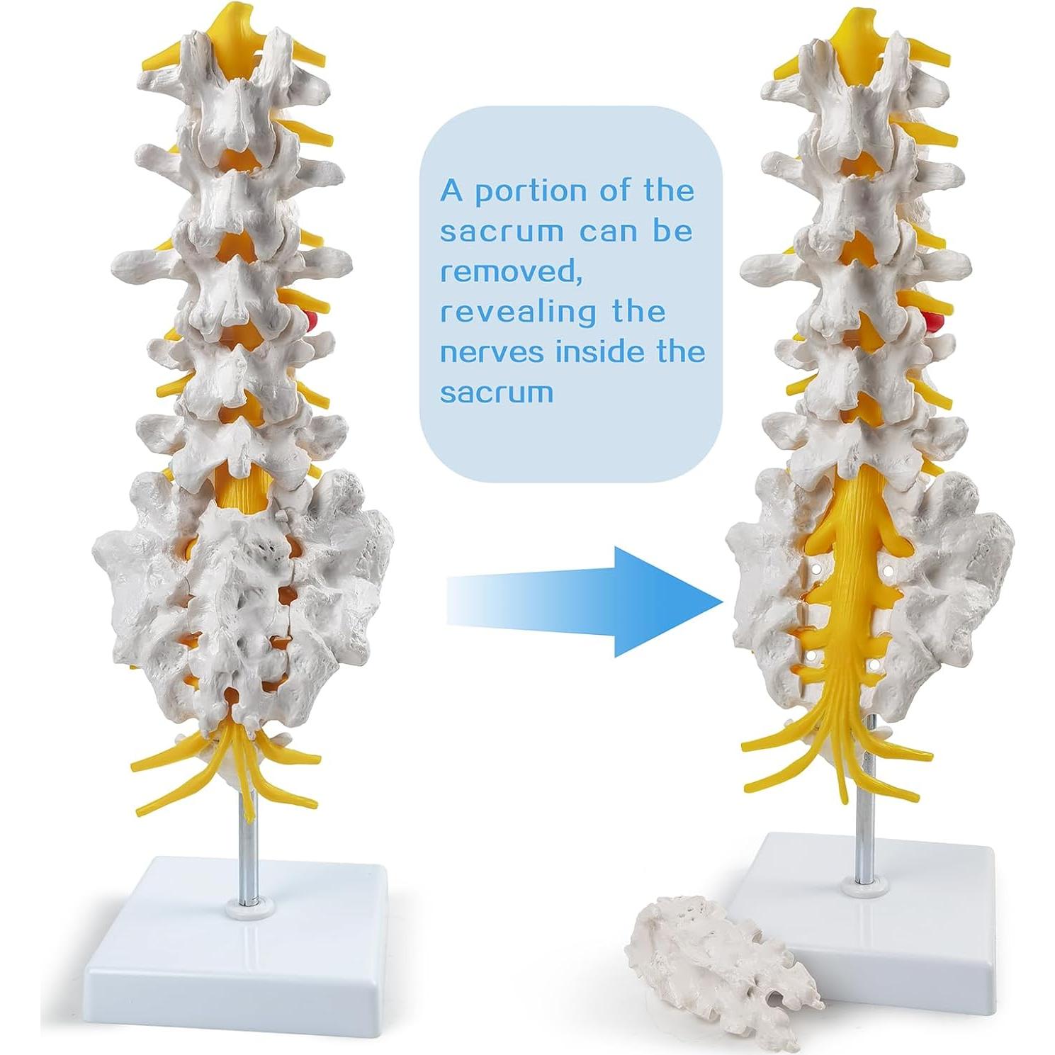 Modelo de Columna Lumbar 3D HADWYN - Anatomía Realista