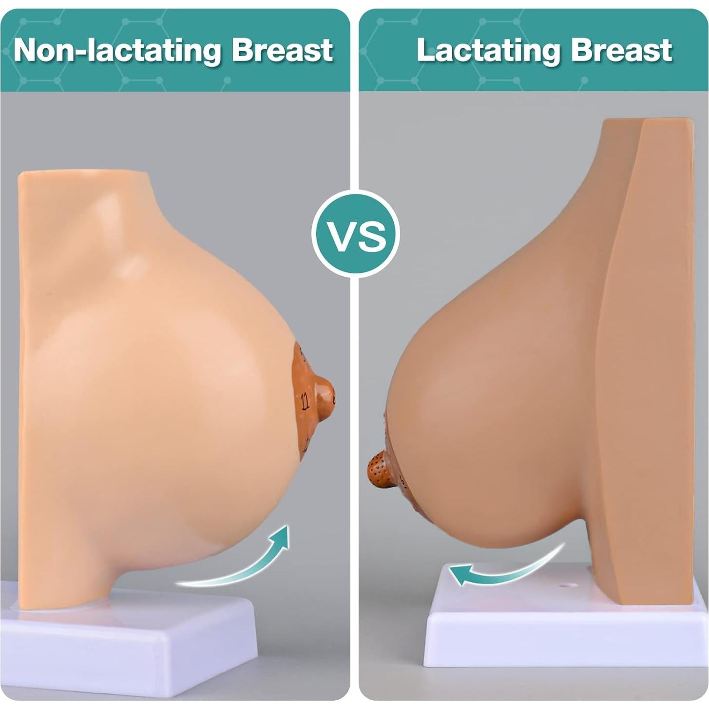 Modelo de Anatomía de Mama Lactante Ultrassist con Tarjeta