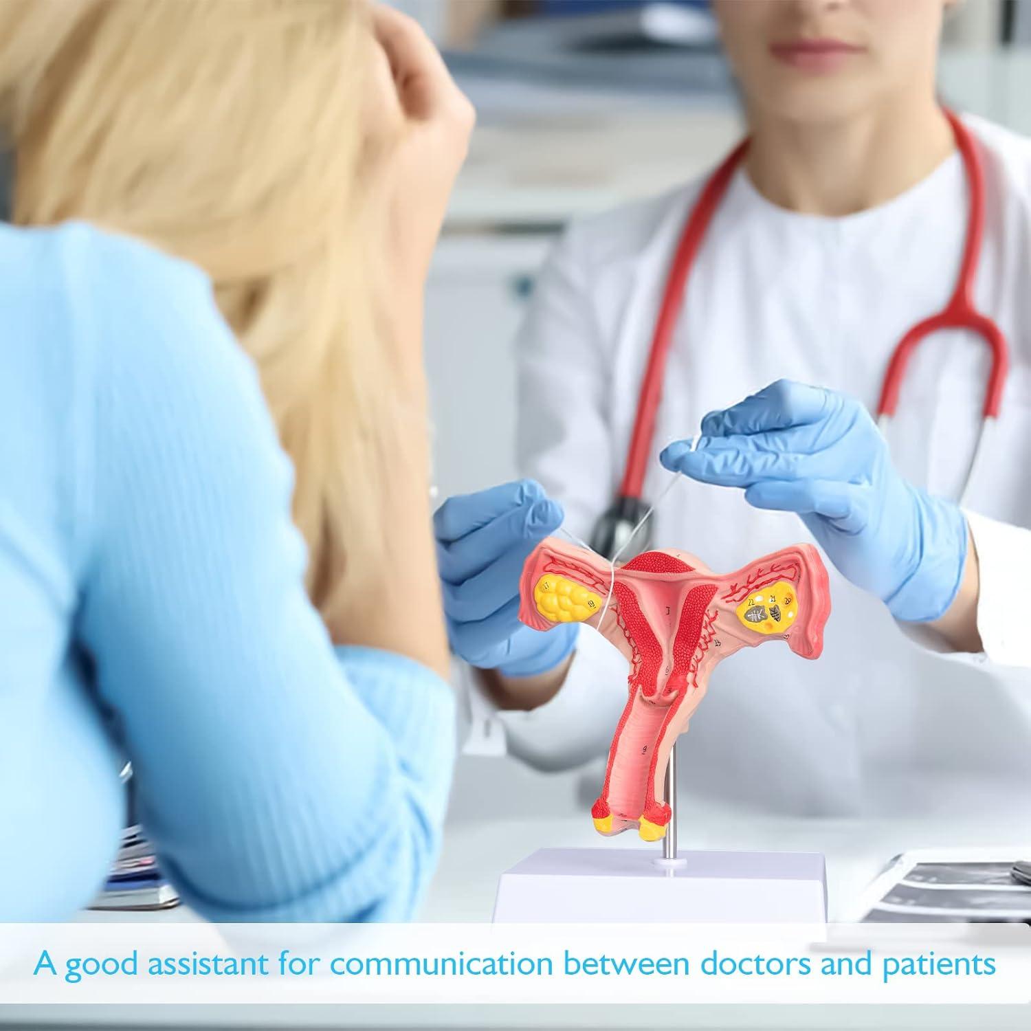 Modelo de Órgano Reproductor Femenino ANNWAN a Tamaño Real