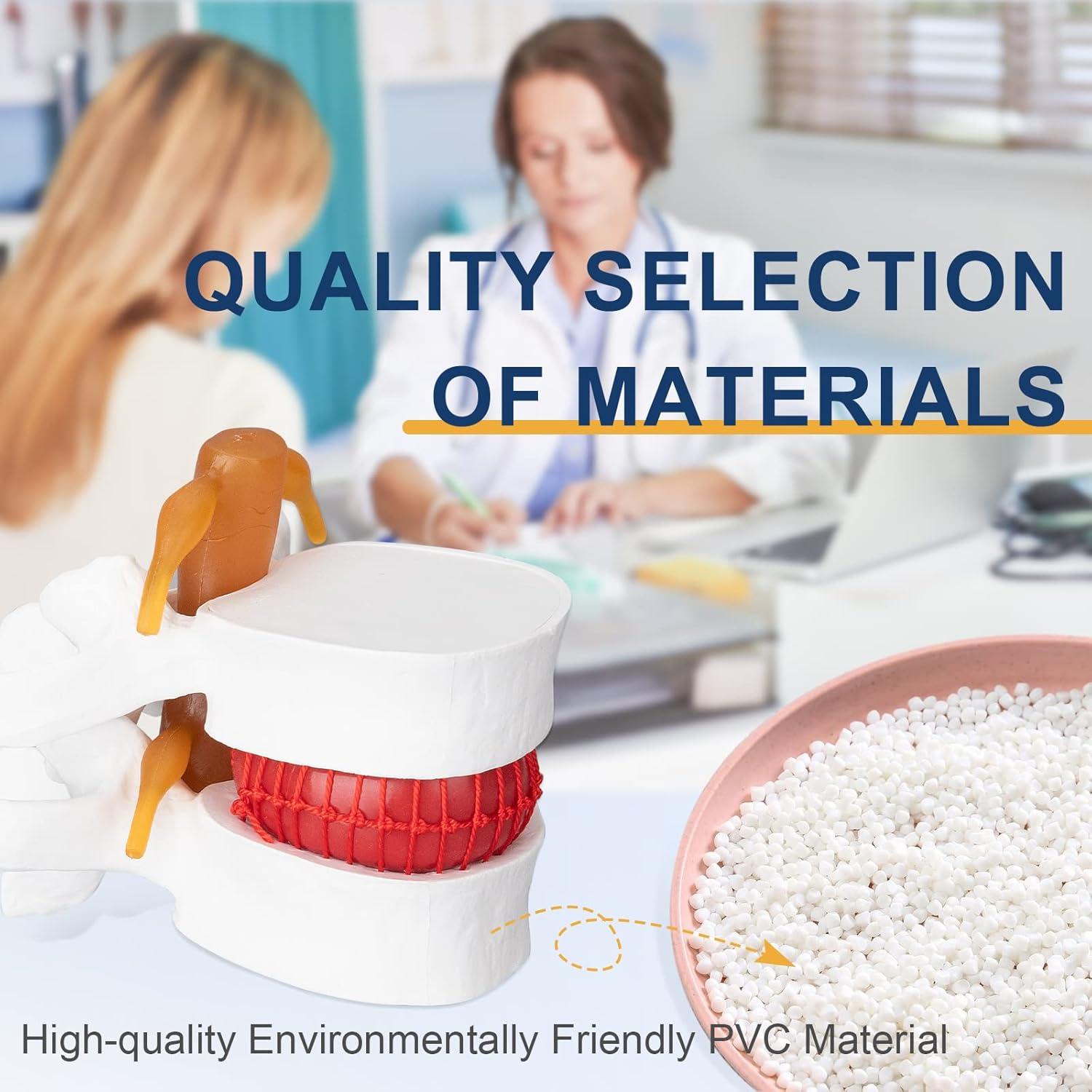 Modelo Anatómico de Hernia de Disco Lumbar Healthible - PVC 1.5X