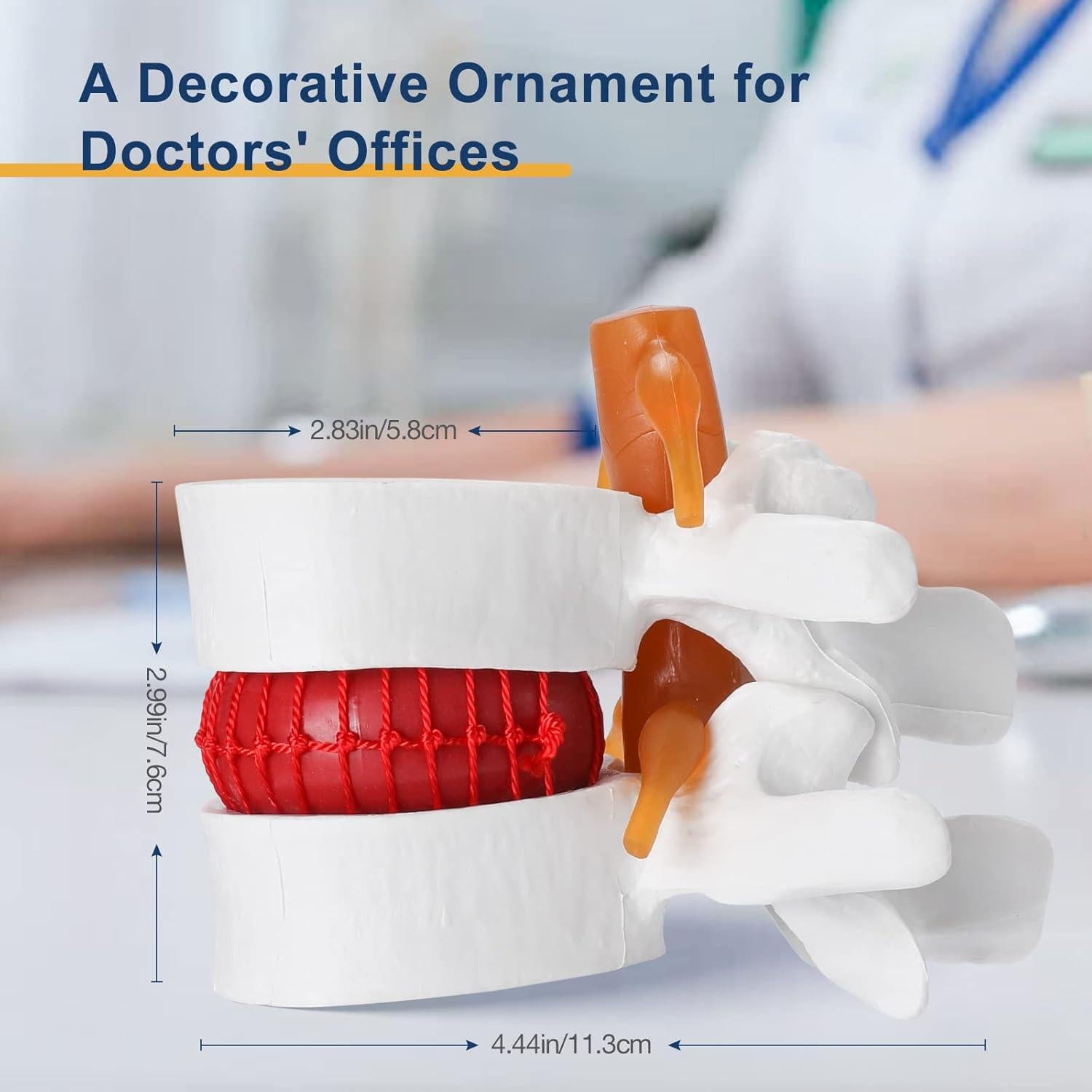 Modelo Anatómico de Hernia de Disco Lumbar Healthible - PVC 1.5X