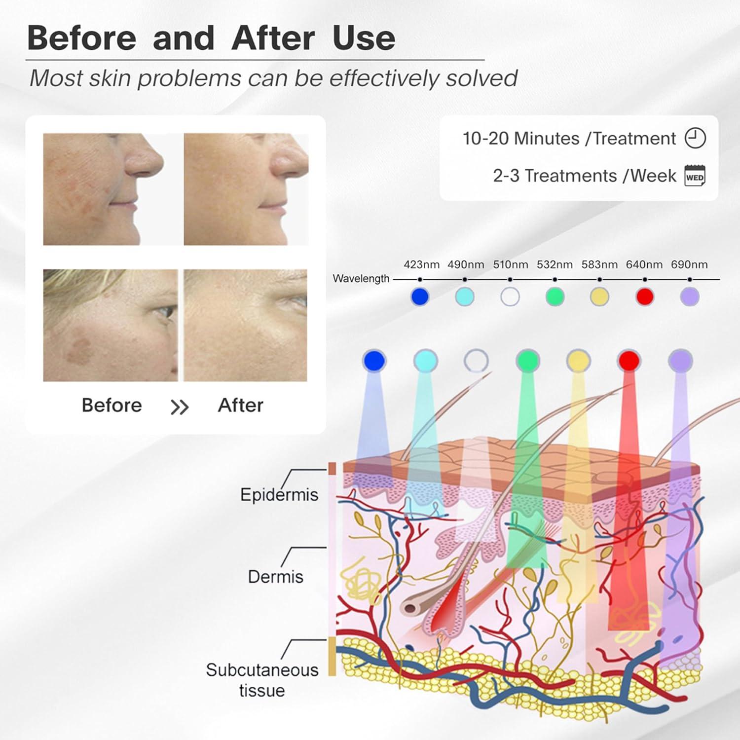 Máscara LED Terapia de Luz Roja 7 Colores JY-A025 34.7x24.6cm