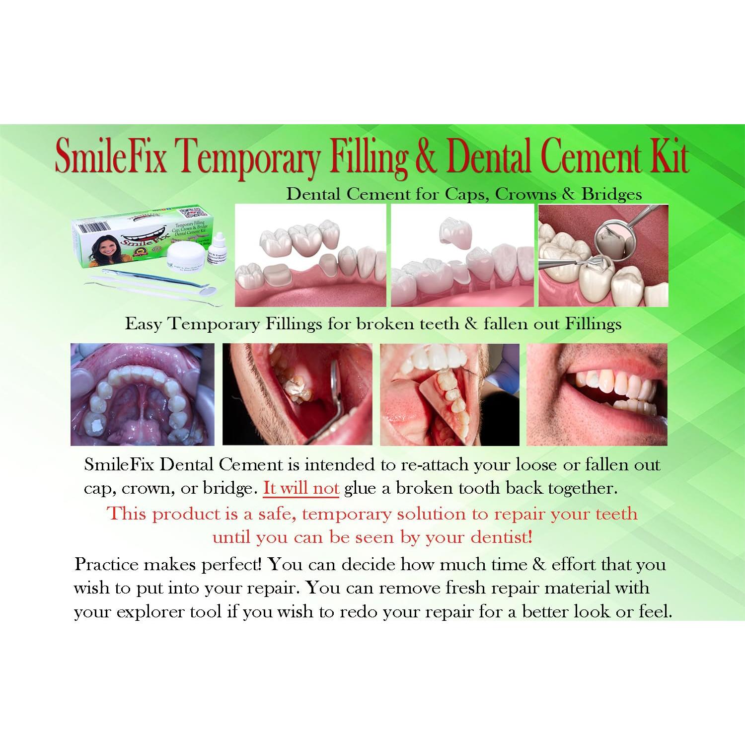 Kit de Reparación Dental SmileFix - Relleno y Cemento Temporal