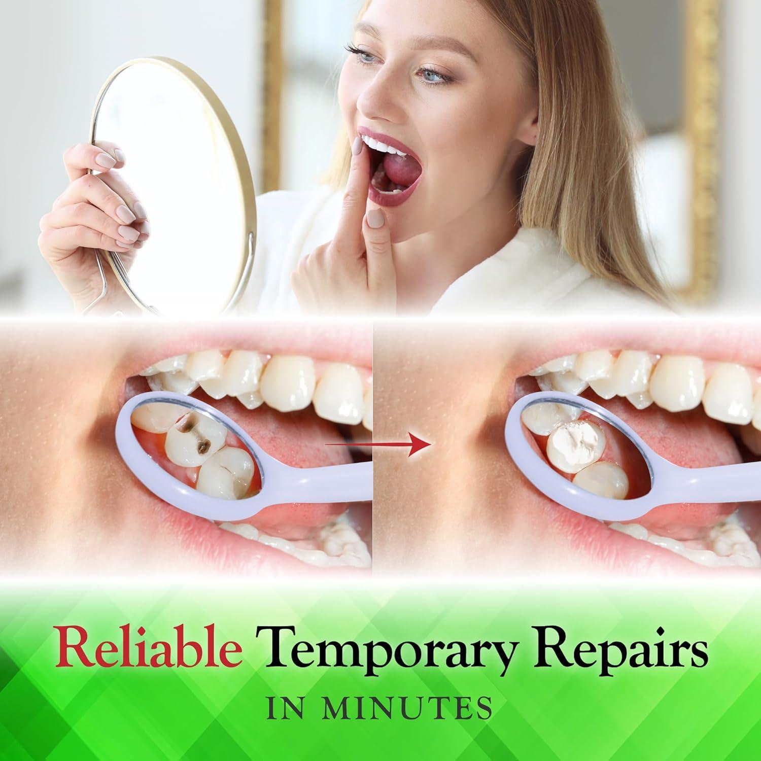 Kit de Reparación Dental SmileFix - Relleno y Cemento Temporal