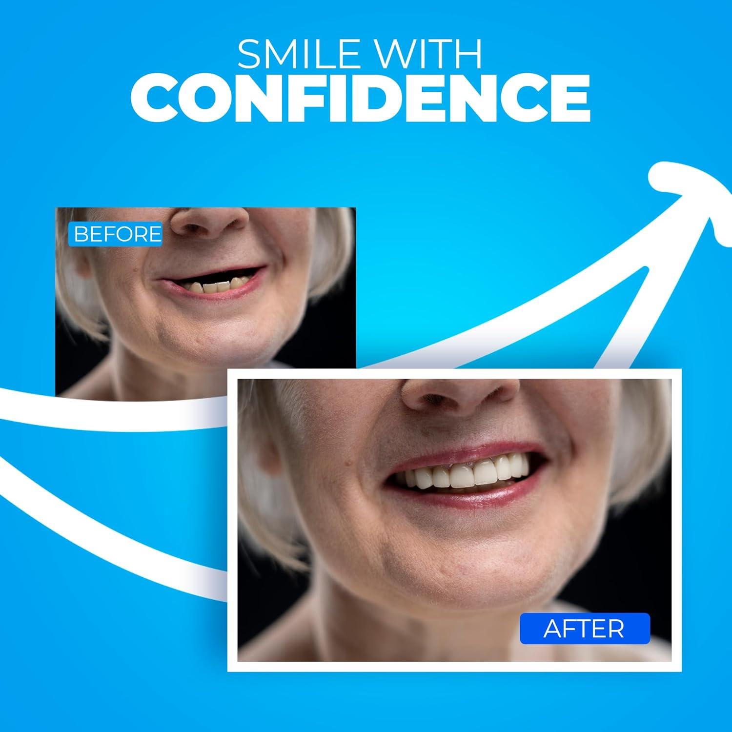 Kit de Prótesis Dental DIY Chemoment - 12 Piezas, Ajuste Personalizado