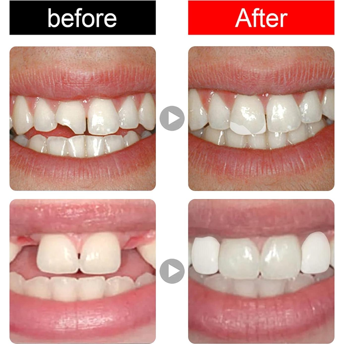 168 Piezas Dientes Falsos Dentales Resina Acrílica A2