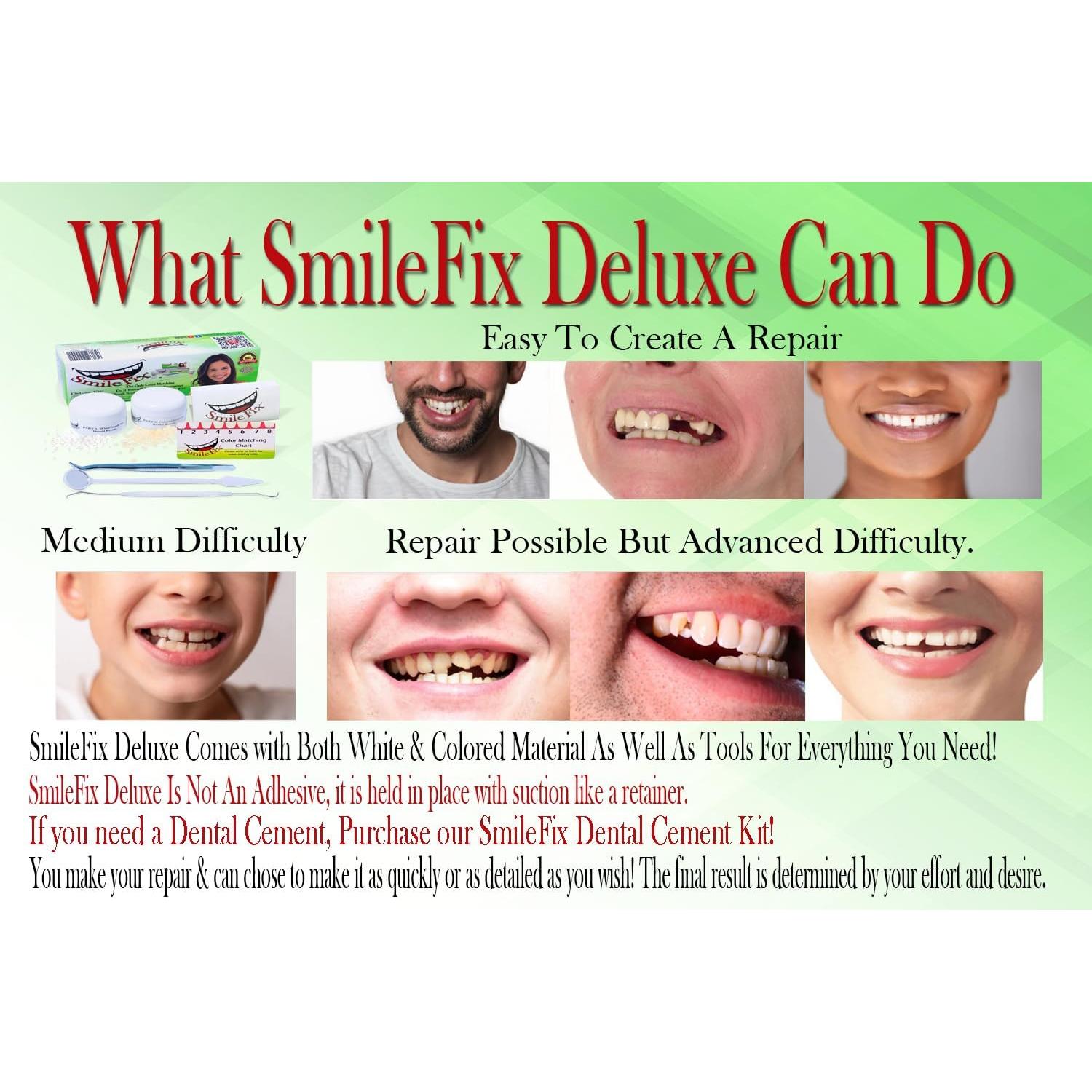 Kit de Reparación Dental SmileFix Deluxe - Herramientas y Perlas