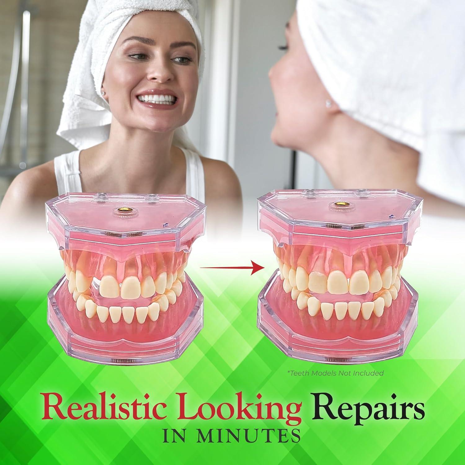 Kit de Reparación Dental SmileFix Deluxe - Herramientas y Perlas