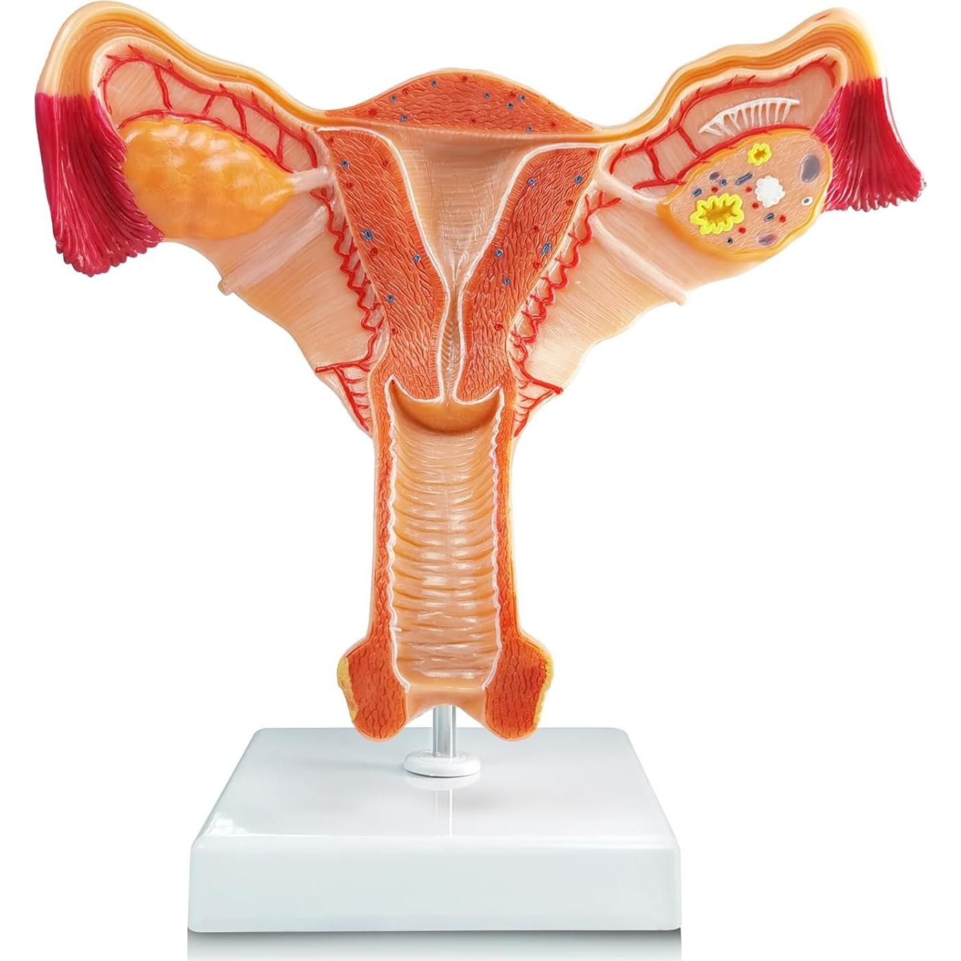 Modelo Anatómico Utero y Ovario Humano Merinden Realista