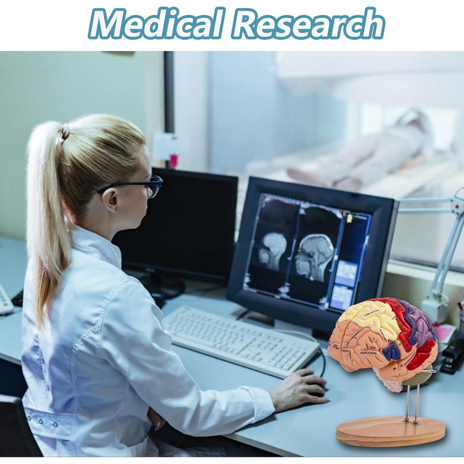 Modelo Anatómico del Cerebro Humano 2X SOEPOTIX Desmontable