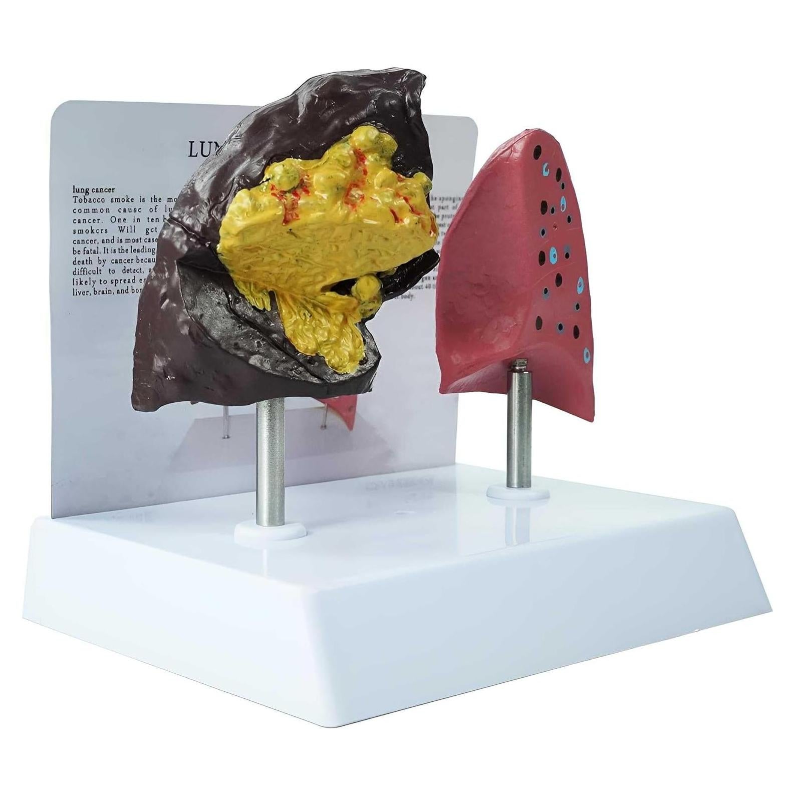 Modelo Anatómico de Pulmón Fumador vs Saludable PVC 21.96x13.99cm