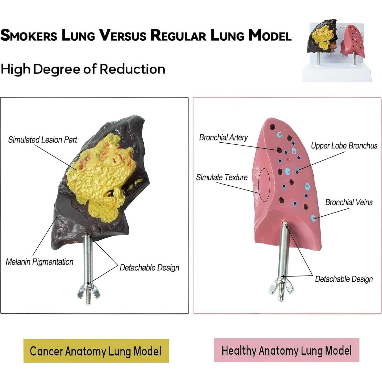 Modelo Anatómico de Pulmón Fumador vs Saludable PVC 21.96x13.99cm