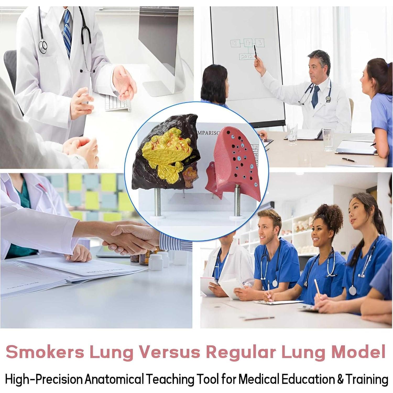 Modelo Anatómico de Pulmón Fumador vs Saludable PVC 21.96x13.99cm