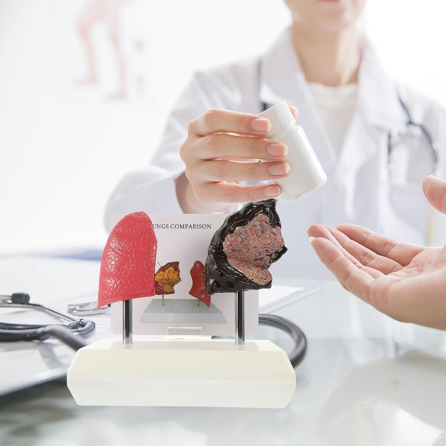 Molde de Estructura Pulmonar Healvian 1:1 PVC Educativo