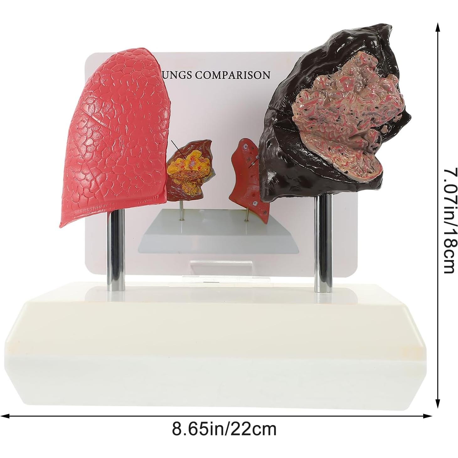 Molde de Estructura Pulmonar Healvian 1:1 PVC Educativo