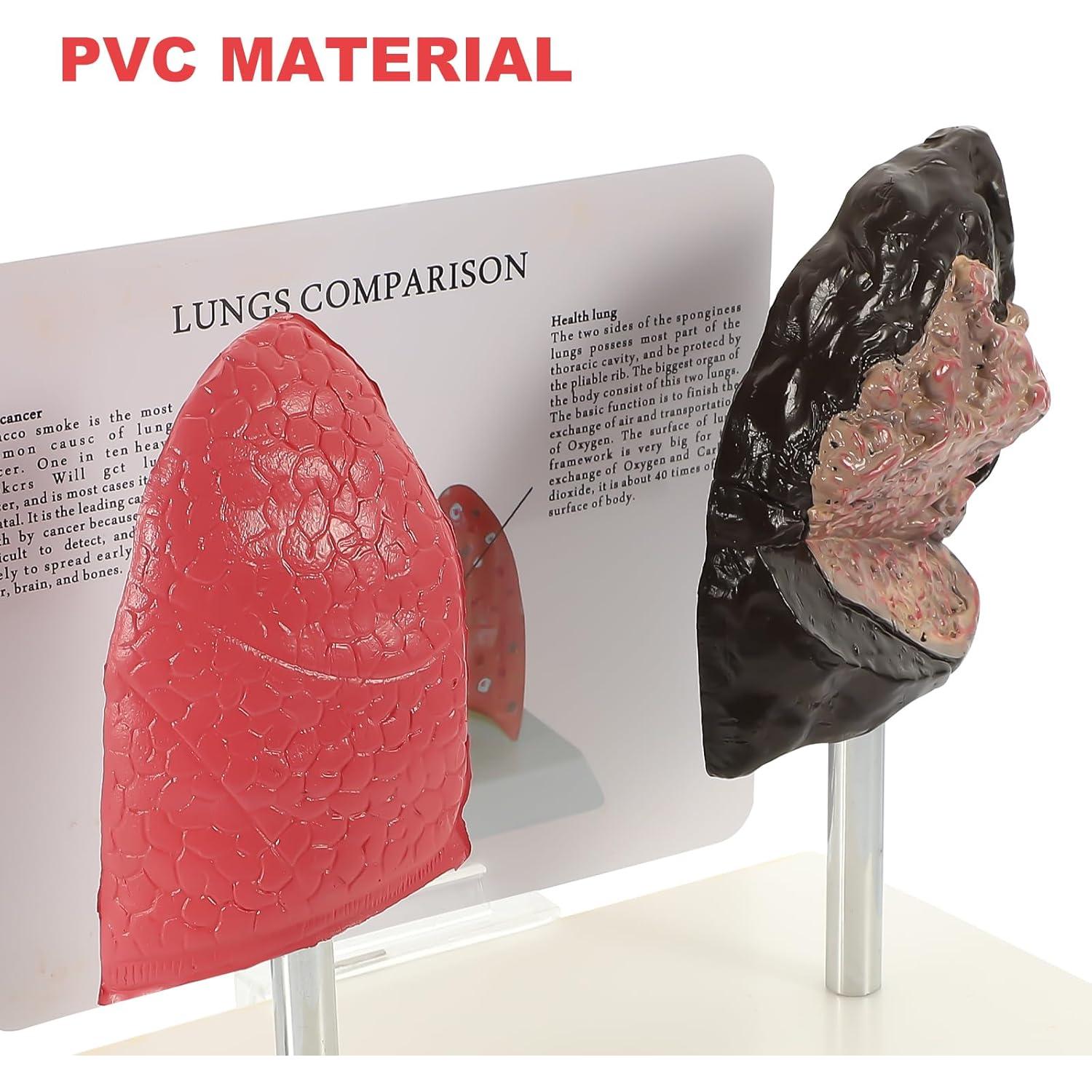 Molde de Estructura Pulmonar Healvian 1:1 PVC Educativo