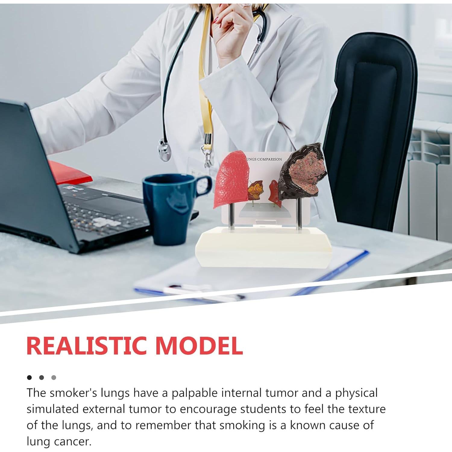 Molde de Estructura Pulmonar Healvian 1:1 PVC Educativo